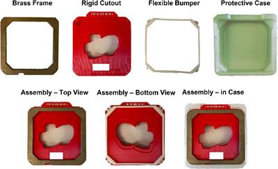 Shaping success: clinical implementation of a 3D-printed electron cutout program in external beam radiation therapy